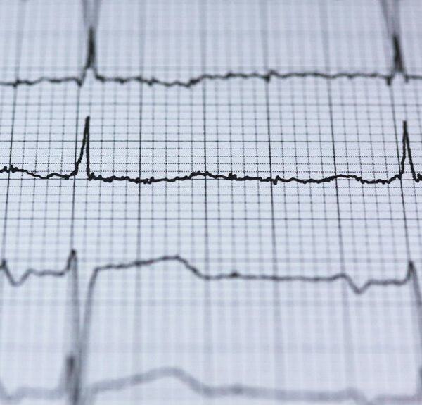 Stellar Pulse 981278986 Fusion Beam
